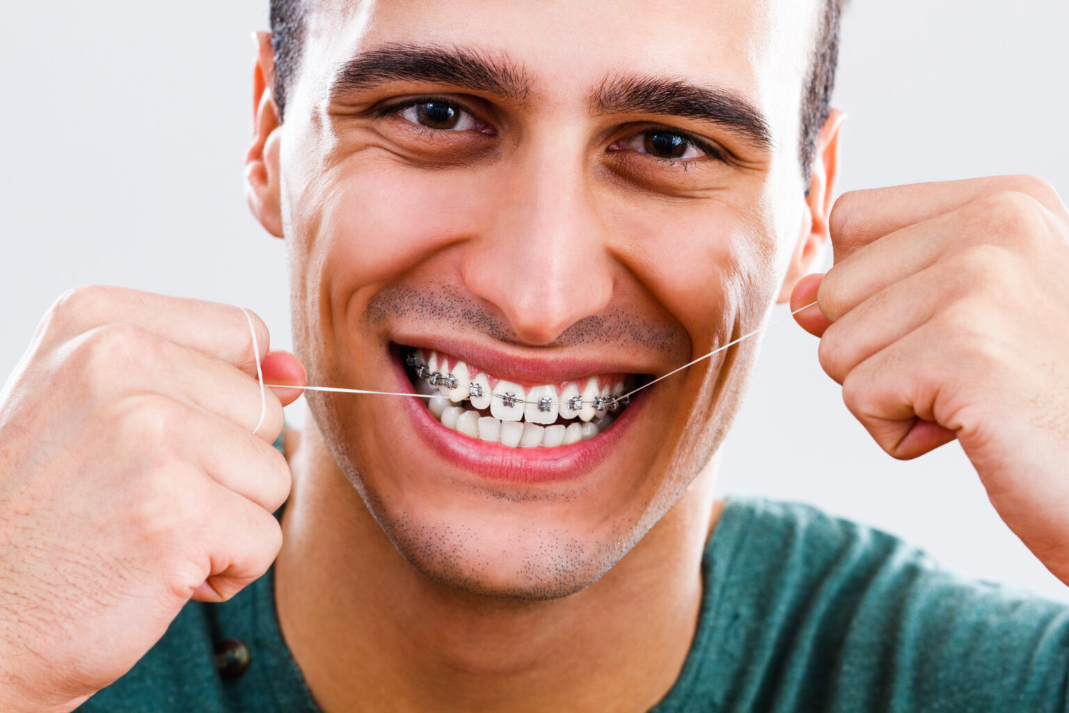 Flossing with braces How to do it the right way