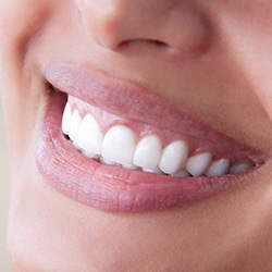 cosmetic-dentistry-5