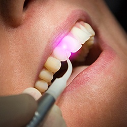 cosmetic-dentistry-6