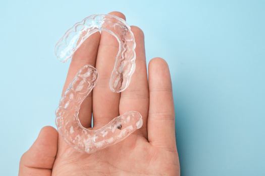 aligners
