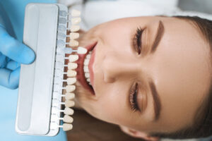 Young woman taking care of teeth stock photo